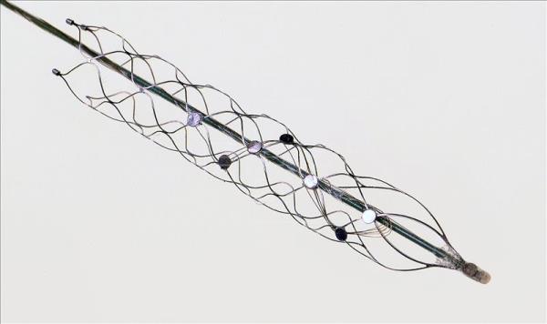 australianscientistsdevelopbionicspineforparalysedpatients